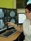 Ilustrační foto k článku: Včasná diagnostika je pro léčbu rakoviny prsu nejzásadnější: Nepodceňujme prevenci!