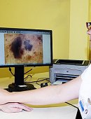 Ilustrační foto k článku: Na kožní ambulanci blanenské nemocnice nově nabízejí vyšetření digitálním dermatoskopem